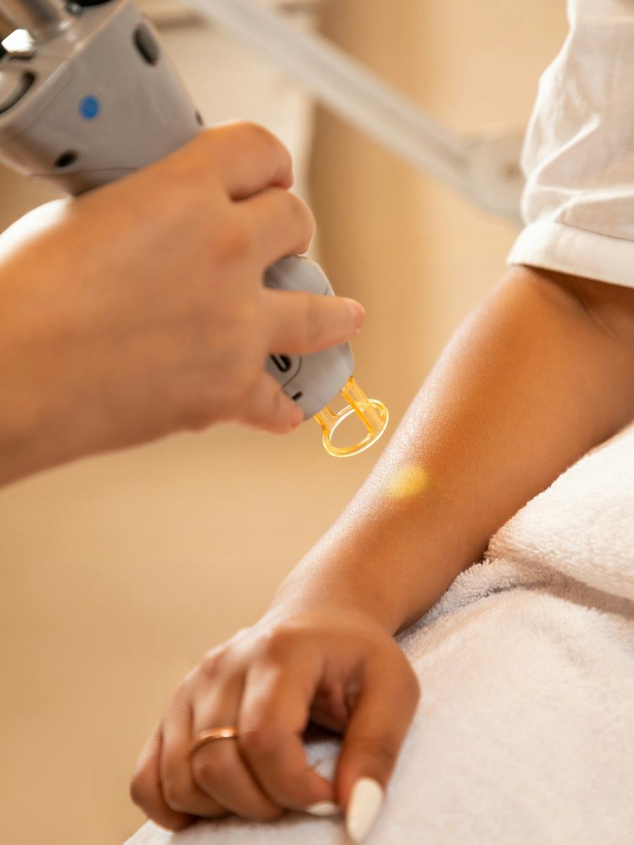 Epilazione laser sul braccio in cabina estetica